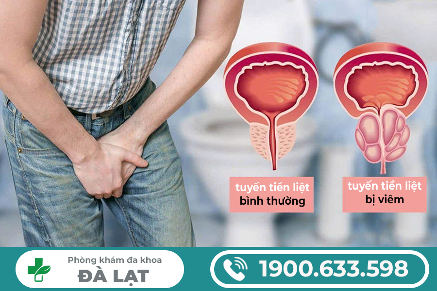 Hình ảnh minh họa